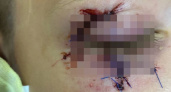 В Пронском районе школьник дважды ударил одноклассника в очках в глаз