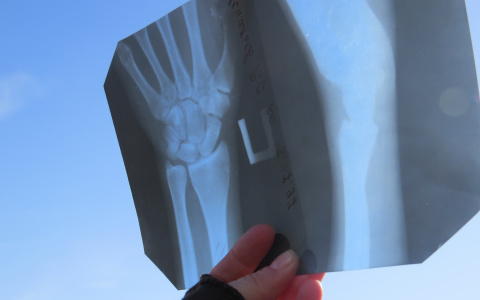 В травмпуткте на Чкалова рентген отключается из-за скачков напряжения