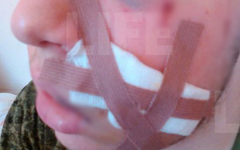 СМИ: рязанский школьник ножом ударил одноклассника в лицо